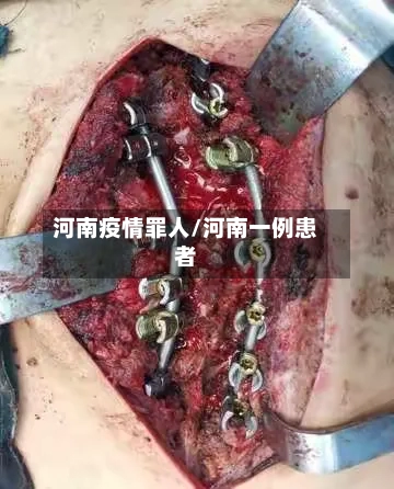 河南疫情罪人/河南一例患者-第2张图片